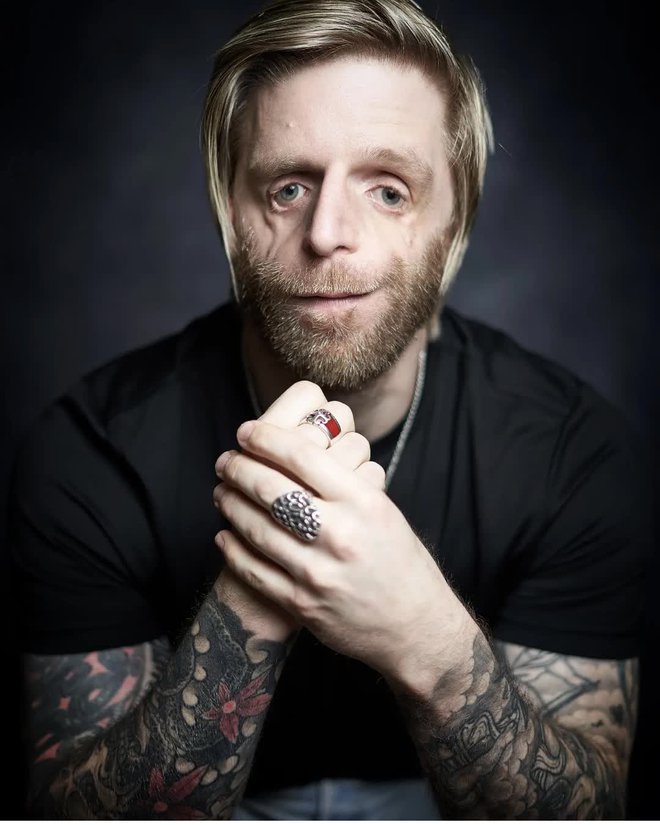 Bị gia đình bỏ rơi khi chưa tròn 2 ngày tuổi vì mắc bệnh hiếm gặp, cuộc sống sau 37 năm của cậu bé mặt chim khiến ai nấy đều ngỡ ngàng  - Ảnh 3.