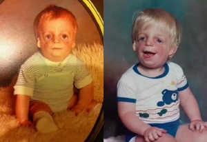 Bị gia đình bỏ rơi khi chưa tròn 2 ngày tuổi vì mắc bệnh hiếm gặp, cuộc sống sau 37 năm của "cậu bé mặt chim" khiến ai nấy đều ngỡ ngàng