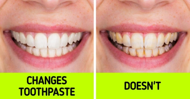 Bạn có đang vệ sinh răng miệng sai cách? Bạn có đang vệ sinh răng miệng sai cách? - 5