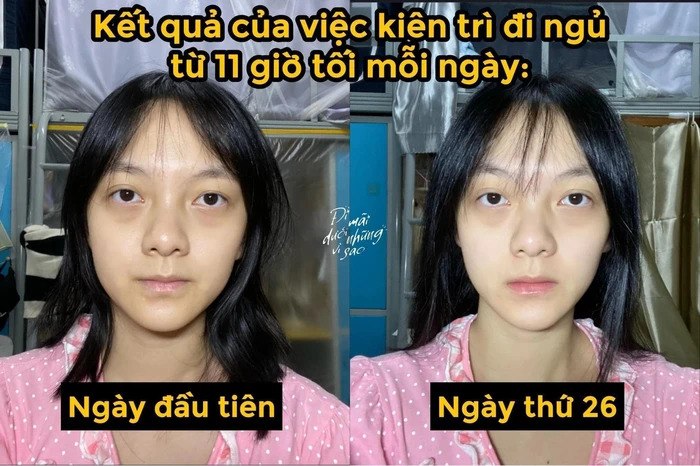 Cô gái có màn thay đổi làn da ngoạn mục nhờ đi ngủ, chị em áp dụng ngay để có da đẹp kịp đón Tết - 6