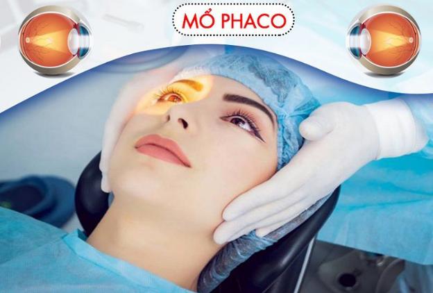 Phẫu thuật Phaco điều trị đục thuỷ tinh thể có an toàn?