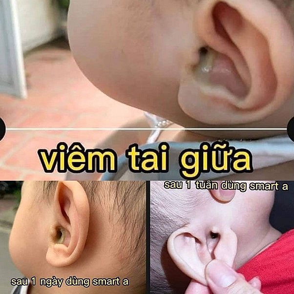 Smart A được giới chuyên môn đánh giá cao tại sự kiện của Hội Nam y Việt Nam