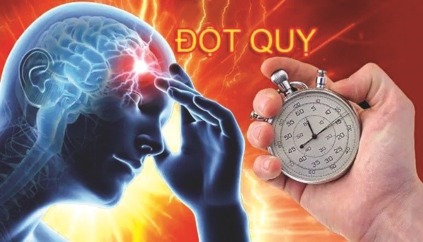 Cách xử trí khi gặp người bị đột quỵ