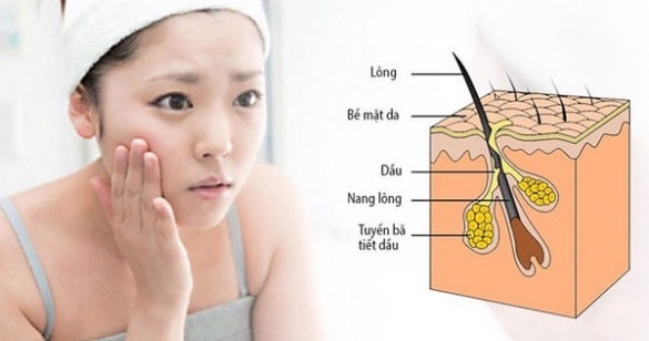 6 nguyên nhân gây da nhờn và cách khắc phục tại nhà