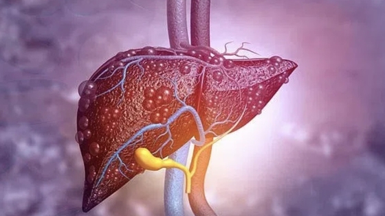 Mẹo hay để bảo vệ gan của bạn khỏi bị bệnh