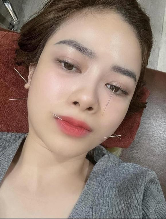 Dương Hoàng Yến, Hari Won cùng loạt sao Việt từng bị liệt nửa mặt